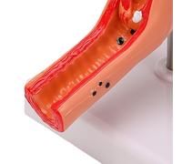 Yinhing Modelo de útero Patológico Femenino con Fibromas Uterinos Pantalla Anatómica Modelo de Anatomía de PVC para Estudio de Enseñanza de Educación de Enfermería en Biología