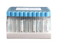 Yinxi Tubo de plástico de citrato de Sodio de coagulación, 100 Uds., vacío estéril de presión Negativa, Tapa Azul, Tubo anticoagulante PRP (Color : 5ml Glass)