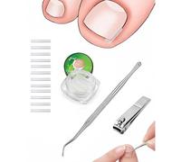 YIPFEN Kit Corrector Uñas Encarnadas 50 Tiras Sin Dolor con Elevador y Cortaúñas - Tratamiento Efectivo y Fácil Uso en Casa para Pies.