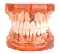 Yosoo Las prótesis dentales Removibles Adulto Modelo de los Dientes del Dentista estándar Patológica Removibles Herramientas de Dientes de enseñanza, Color Naranja