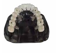 YRQMGSF Modelo de restauración de implantes dentales Modelo de mandíbula sin Dientes para educación Dental y demostraciones