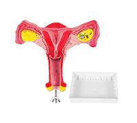 Yuuinnter 1:1 Modelo de Trompas de Falopio de Ovario de úTero Femenino Humano Modelo AnatóMico de AnatomíA Herramientas de EnseñAnza
