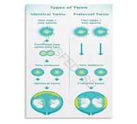 YZWRWRMKTB Placentation of Twins Chart Information Poster Educational Wall-Art Canvas Painting for Obstetrics Department and Home Decor(Framed,12x18inch(30x45cm))