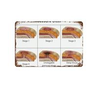 YZWRWRMKTB Pressure Ulcer Stages Metal Tin Sign Anatomy Educational Chart Diagram Vintage Nursing School Wall Decor for Clinic Office 8 X 12 inch
