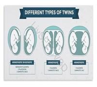 YZWRWRMKTB Twins Placenta Development Educational Chart Anatomical Poster Obstetric Wall-Art Canvas for Student Study Room Home Decor(Unframed,12x18inch(30x45cm))
