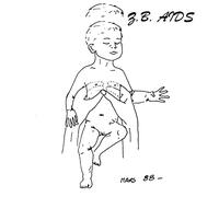 Z.B. Aids - Gestalt [VINYL] [Vinilo]