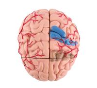 Zunate Modelo Plástico de Anatomía del Cerebro Humano |Desmontado para Montaje, Colorido, Altamente Simulado, Herramienta de Estudio de Neurología, Enseñanza Médica, Exhibición Clínica, Educación del
