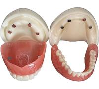 ZWDCVFGK Modelo de dentadura postiza de adsorción de Boca Completa - con 4 implantes de demostración para enseñanza Escolar, demostración, Suministros de Laboratorio